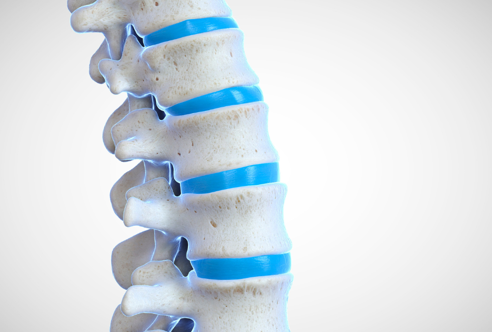 Revolutionizing Spinal Treatment: Kyphoplasty Through the Lens of Orthopedic Expertise