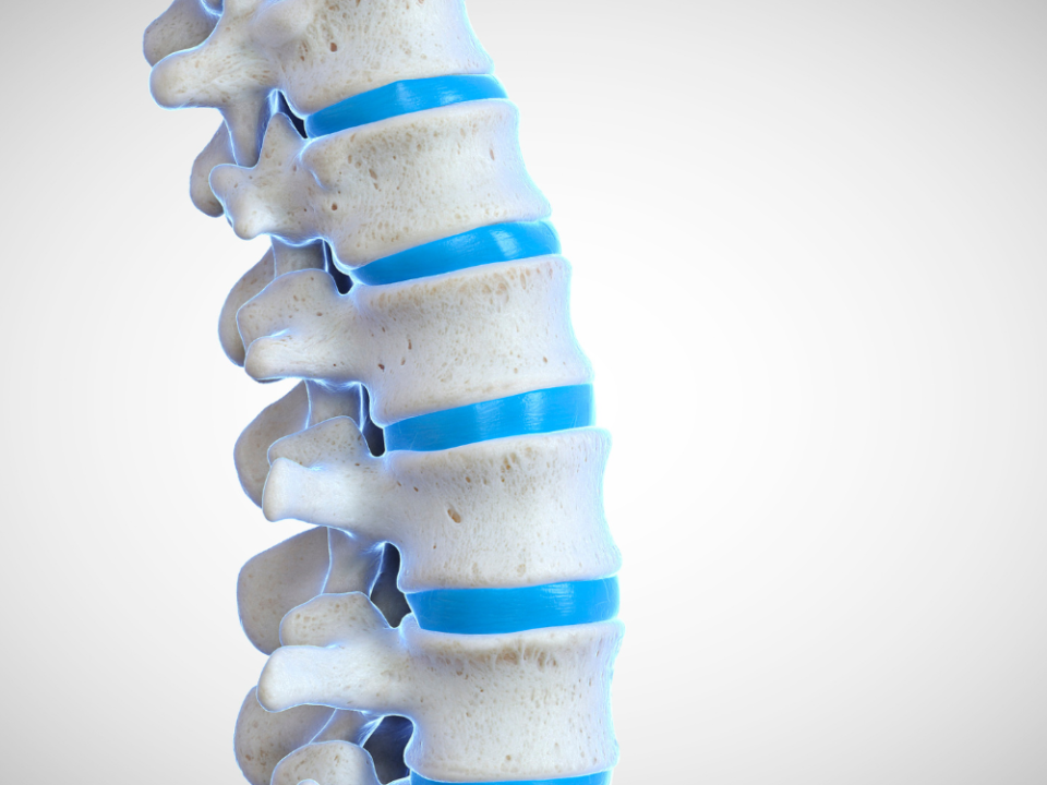 Revolutionizing Spinal Treatment: Kyphoplasty Through the Lens of Orthopedic Expertise