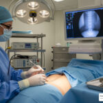 nerve ablation procedure