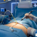 who is a good candidate for intracept procedure