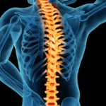 rhomboid muscle pain spinal cord stimulator