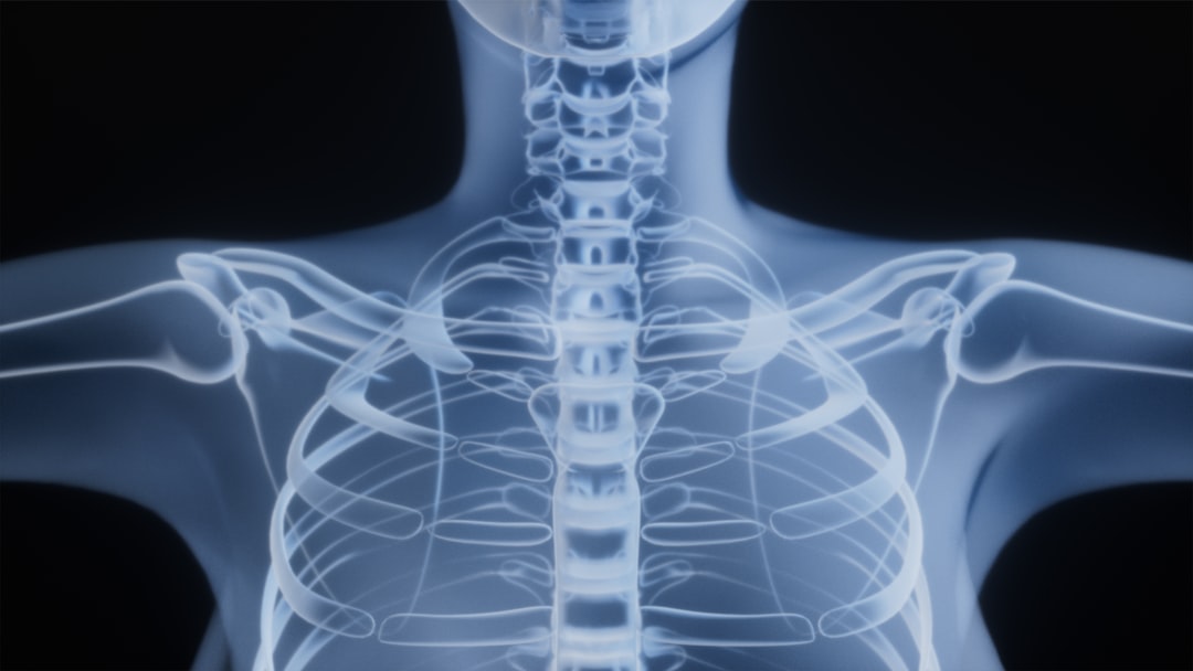 pain under scapula shoulder blade anatomy