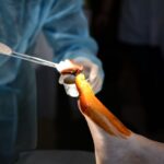 foot tendon malpractice coverage