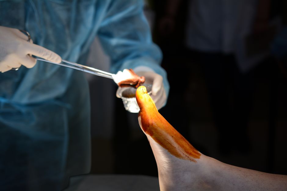 foot tendon malpractice coverage