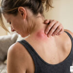 muscle knot in shoulder blade